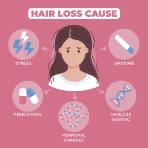 Causes of the hair loss in representive way